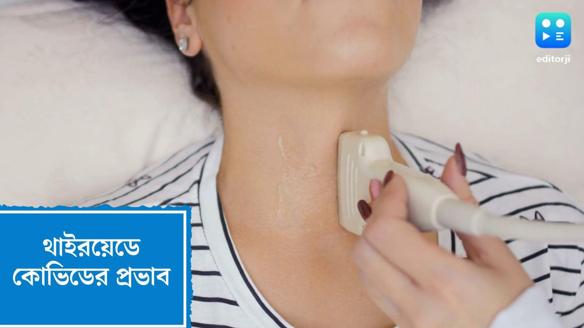 Thyroid and Covid-19 : থাইরয়েড গ্রন্থিতে দীর্ঘকালীন প্রভাব ফেলতে পারে কোভিড, বলছে গবেষণা