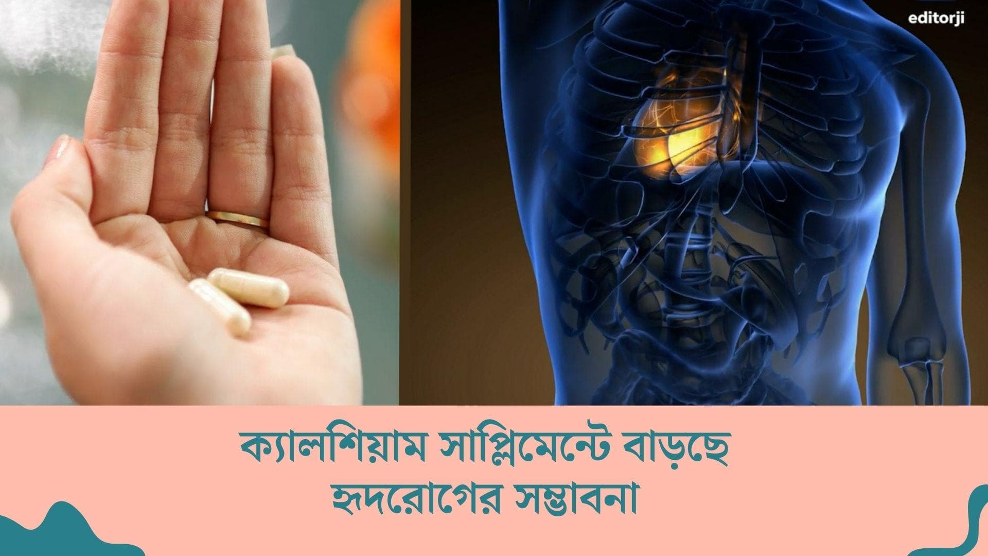 Heart Disease from Calcium: ক্যালশিয়াম সাপ্লিমেন্টে বাড়ছে হৃদরোগের সম্ভাবনা, সতর্ক করলেন গবেষকরা