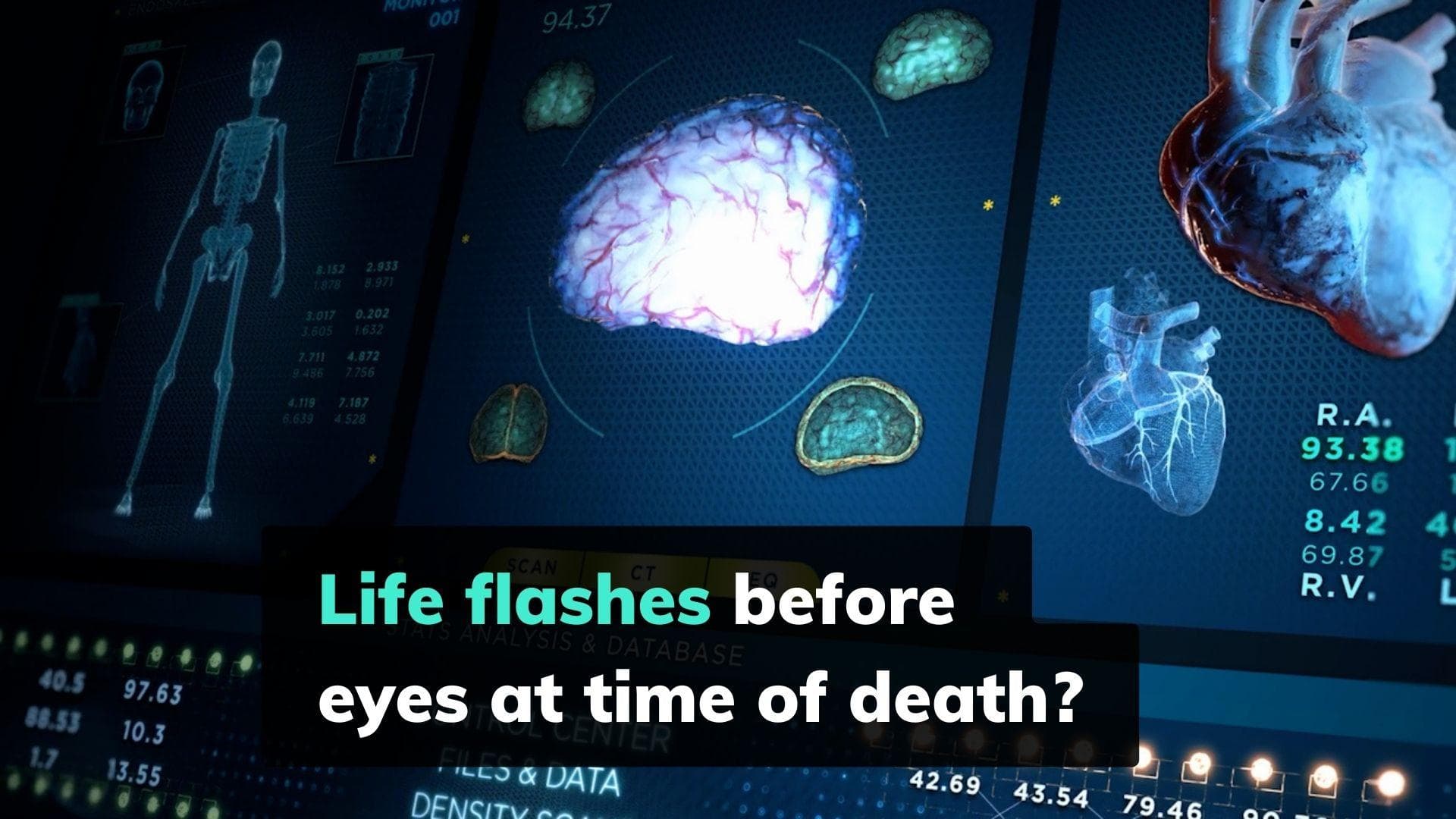 Man's death during brain wave recording leads to unique study: life flashes before eyes at time of death?