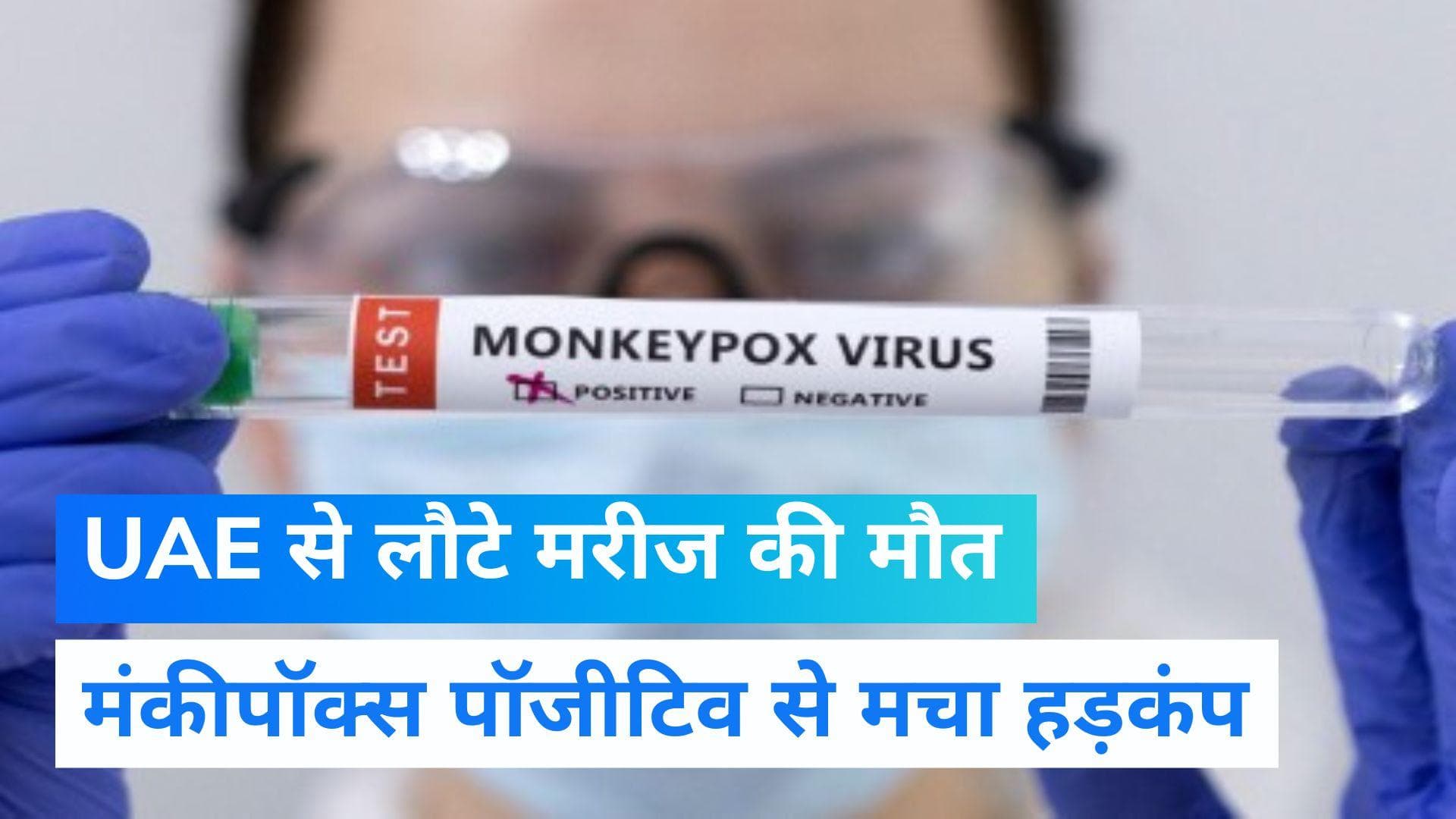 Monkeypox Suspected Dies: UAE से लौटे जिस शख्स की केरल में हुई मौत, वह निकला मंकीपॉक्स पॉजिटिव