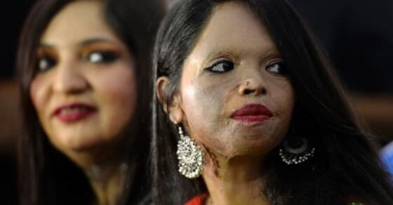 Why have acid attacks on women become common? | DataBaaz 