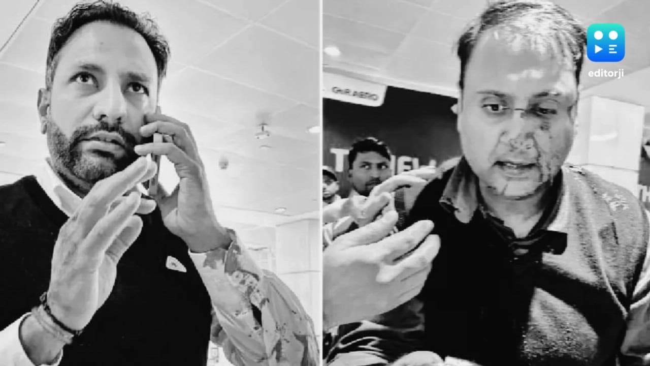 Passenger beaten by off-duty Air India Express pilot suffers nasal fracture, seeks justice