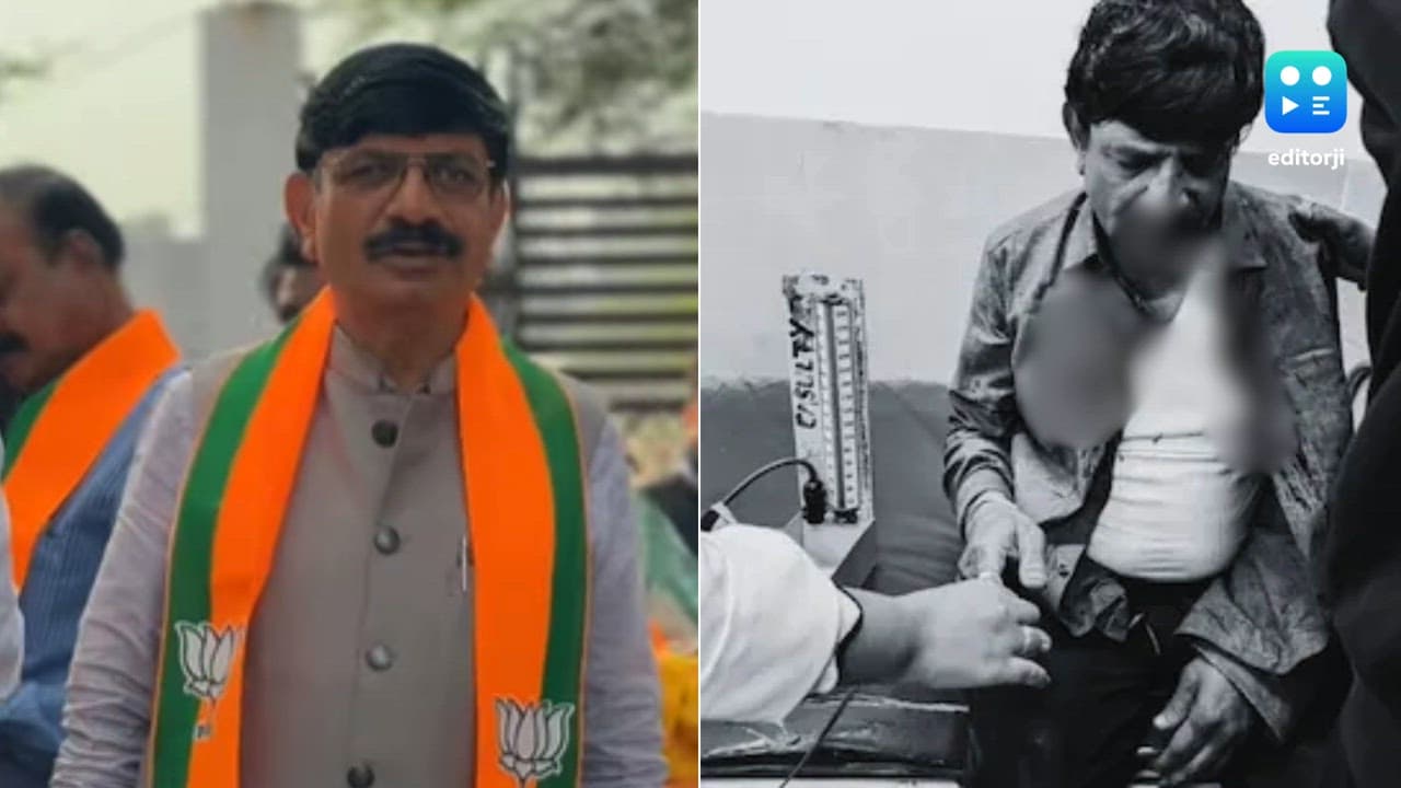 Nagpur civic polls: BJP candidate injured in scuffle; cops launch probe