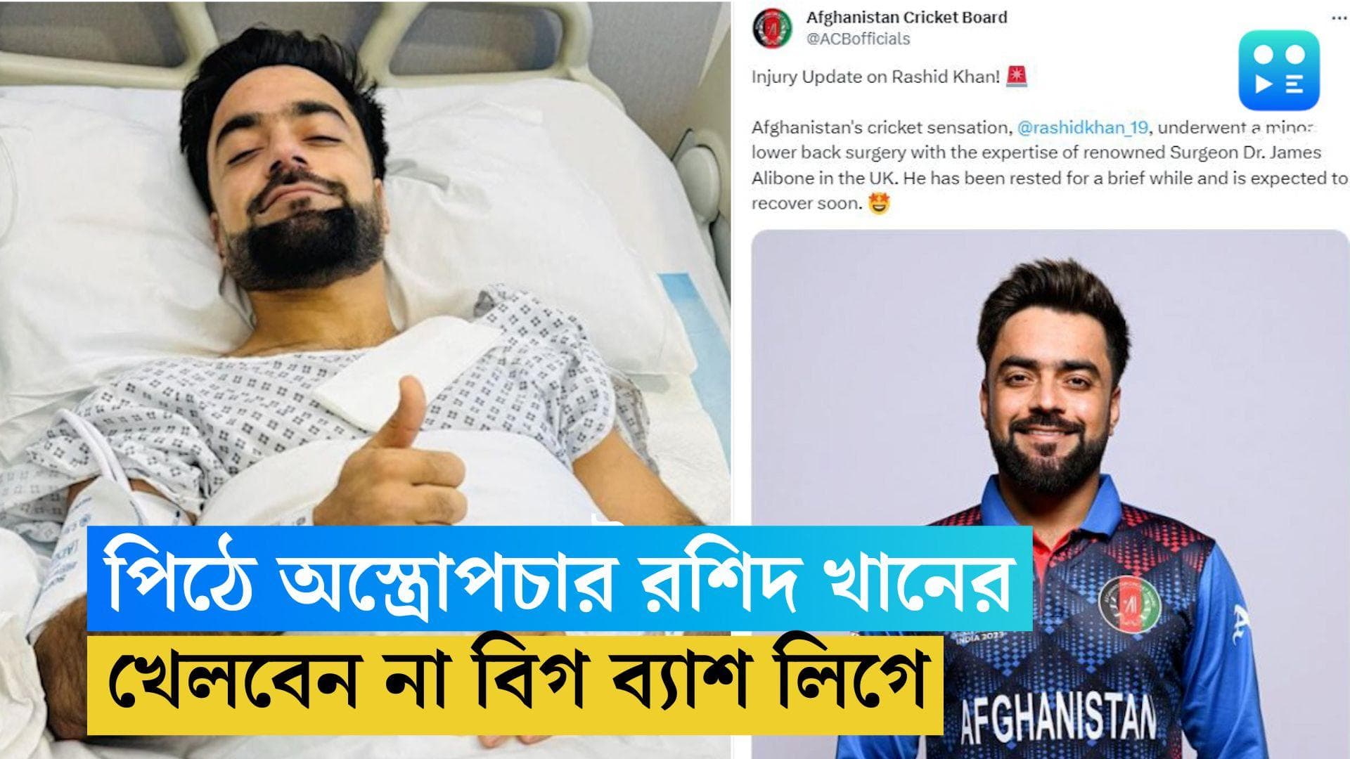 Rashid Khan Surgery: পিঠে চোট, লন্ডনে অস্ত্রোপচার রশিদ খানের, বিগ ব্যাশ লিগে নেই আফগান তারকা