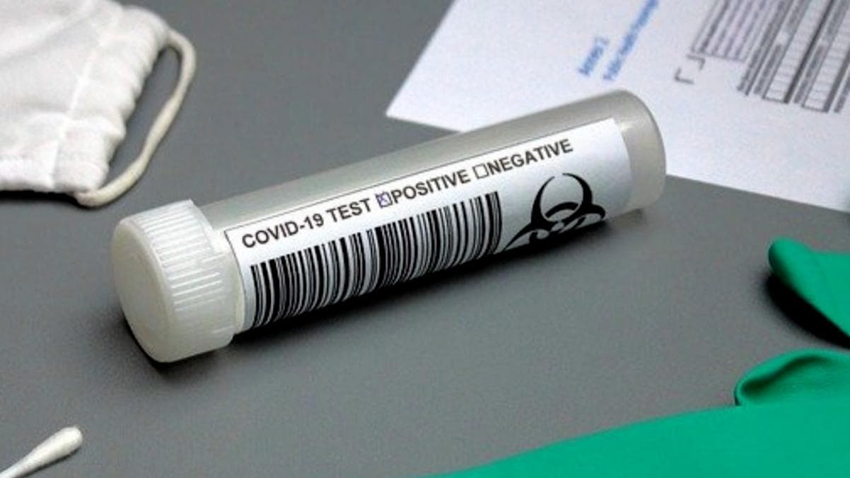 Covid 19: কলকাতার তিন হাসপাতালে আক্রান্ত ১০০ জনের বেশি চিকিৎসক, এনআরএসে কোভিডে আক্রান্ত ৬১