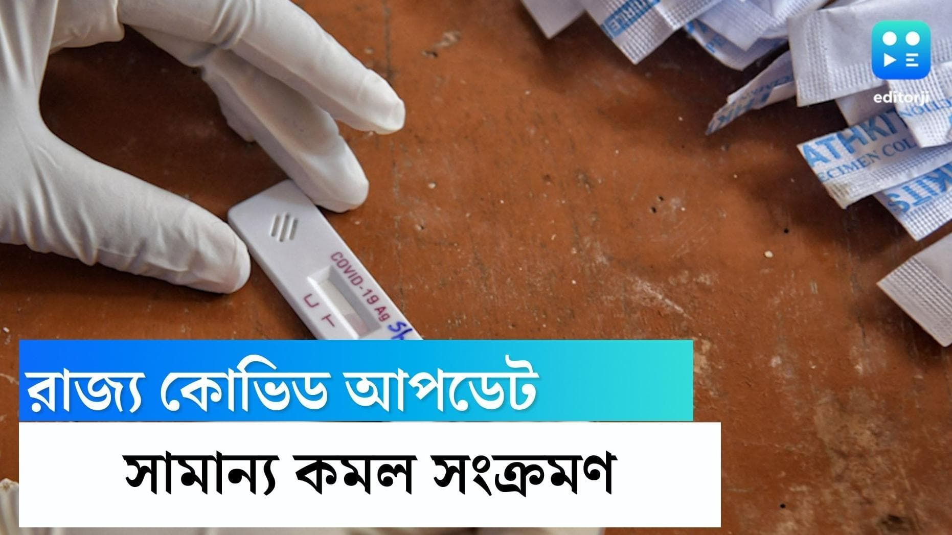 West Bengal Covid update: গত ২৪ ঘণ্টায় করোনা আক্রান্ত হয়েছেন ৭৭৫ জন, মৃত্যু হয়েছে ৪ জনের