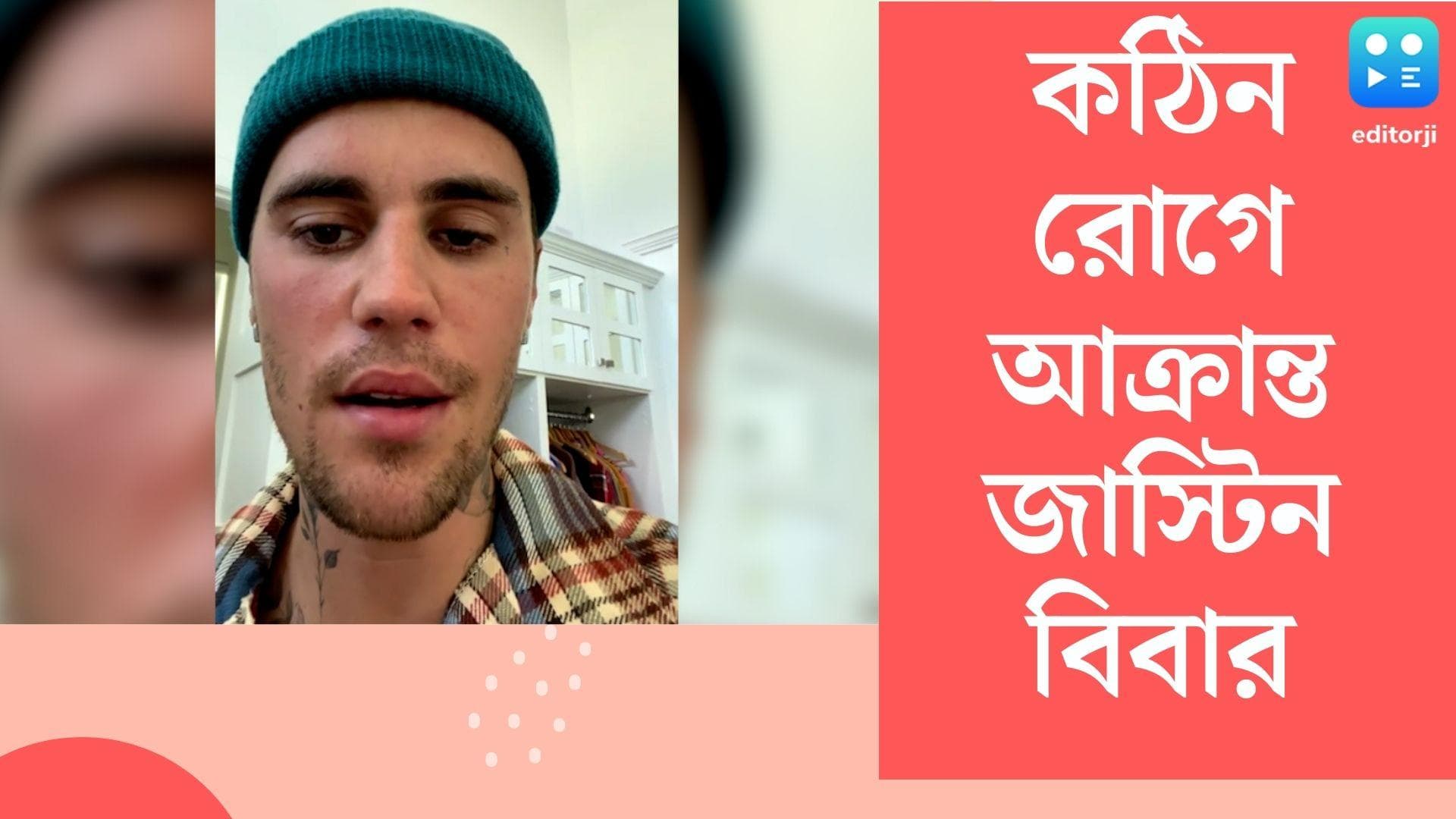 Justin Bieber: মুখের একদিক অসাড়, চোখের পলক পড়ছে না,গুরুতর অসুস্থ পপ গায়ক জাস্টিন বিবার