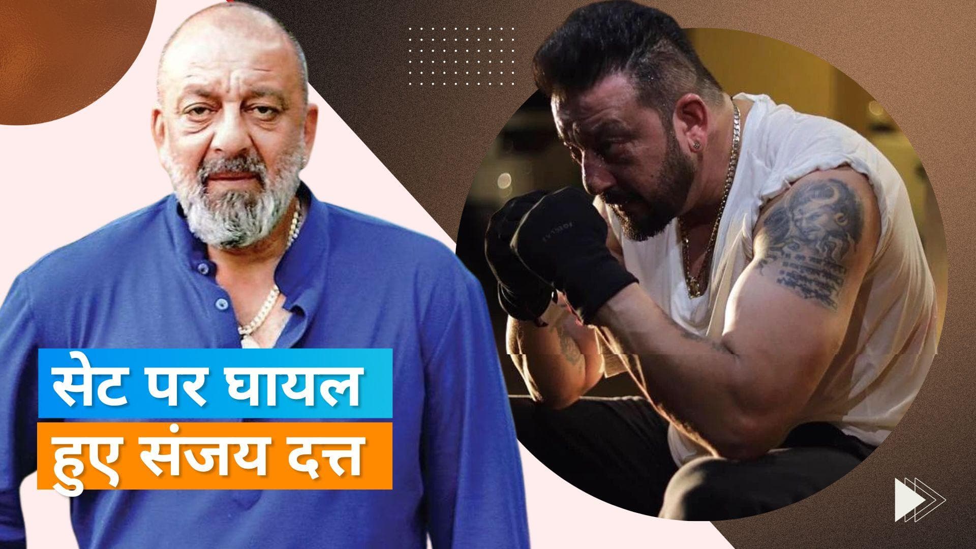 Sanjay Dutt Injured: फिल्म की शूटिंग के दौरान संजय दत्त हुए घायल, जानिए कैसे हुआ हादसा ?