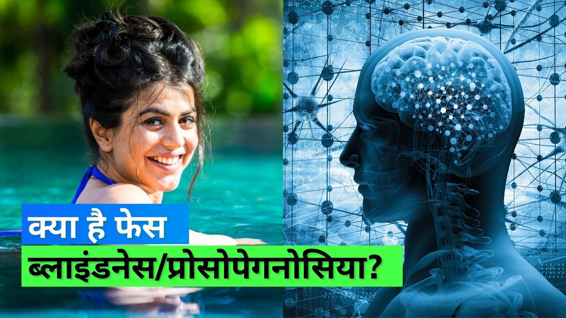 Prosopagnosia: एक्ट्रेस शहनाज़ ट्रेज़री प्रोसोपेगनोसिया से हैं पीड़ित, जानिये बीमारी के बारे में सबकुछ