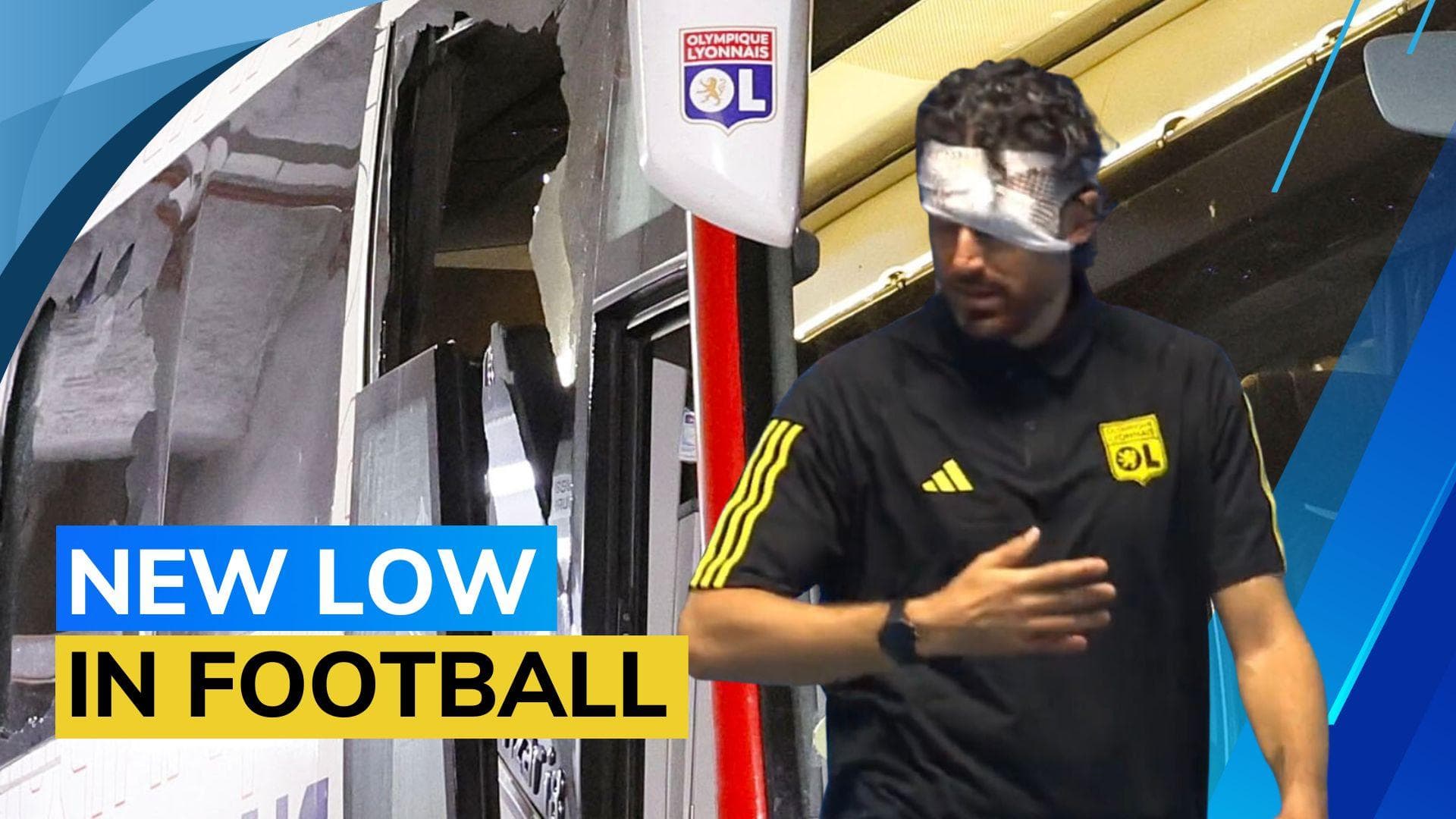 Video: 9 fans detained after Lyon bus attack sees coach Grosso suffer serious face injuries