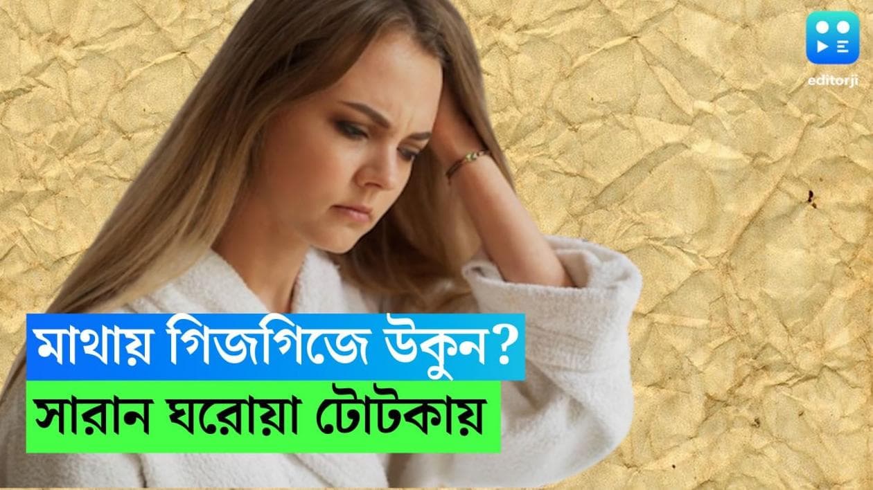 Lice Removal Tips: উকুনে গিজগিজ করছে মাথা? ঘরোয়া পদ্ধতিতেই তাড়ান চুলের শত্রুদের 