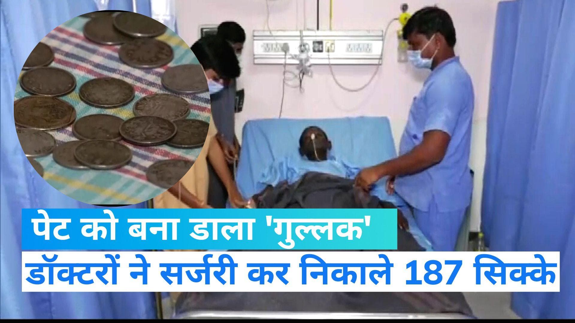 Viral News: पेट में हो रहा था दर्द, सर्जरी हुई तो निकले 187 सिक्के