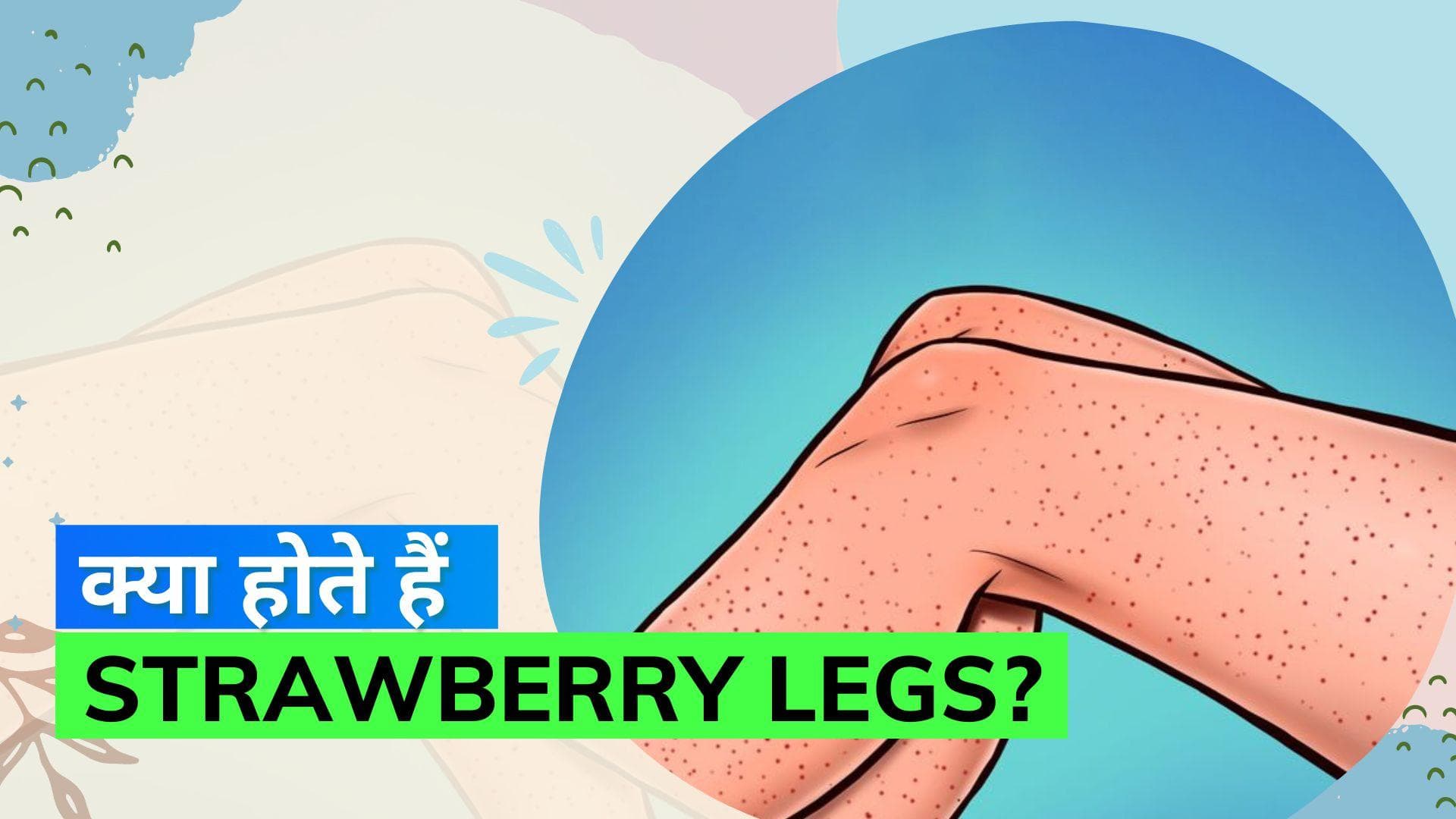 Strawberry Legs: स्ट्रॉबेरी लेग्स की वजह से पैर दिखते हैं खराब? ऐसे पाइये छुटकारा
