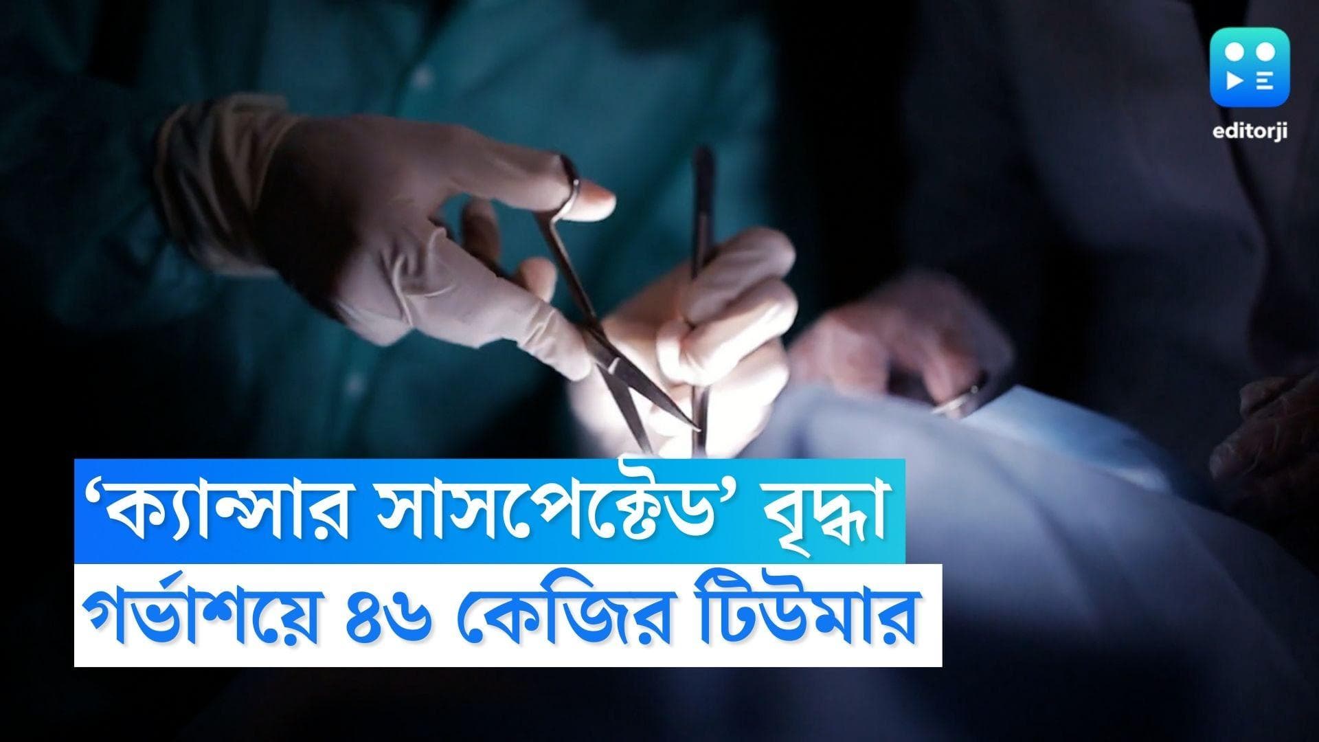 Thakurpukur Cancer Hospital: ‘ক্যান্সার সাসপেক্টেড’ বৃদ্ধার গর্ভাশয়ে ৪৬ কেজির টিউমার