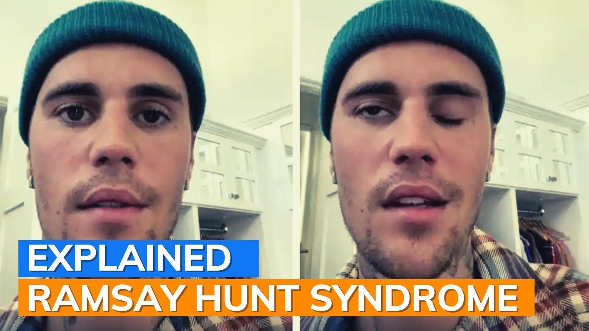 Justin Bieber reveals that he is suffering from facial paralysis 