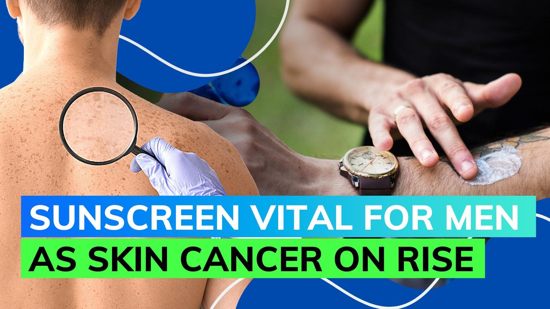  Men are more likely to develop melanoma skin cancer: Study