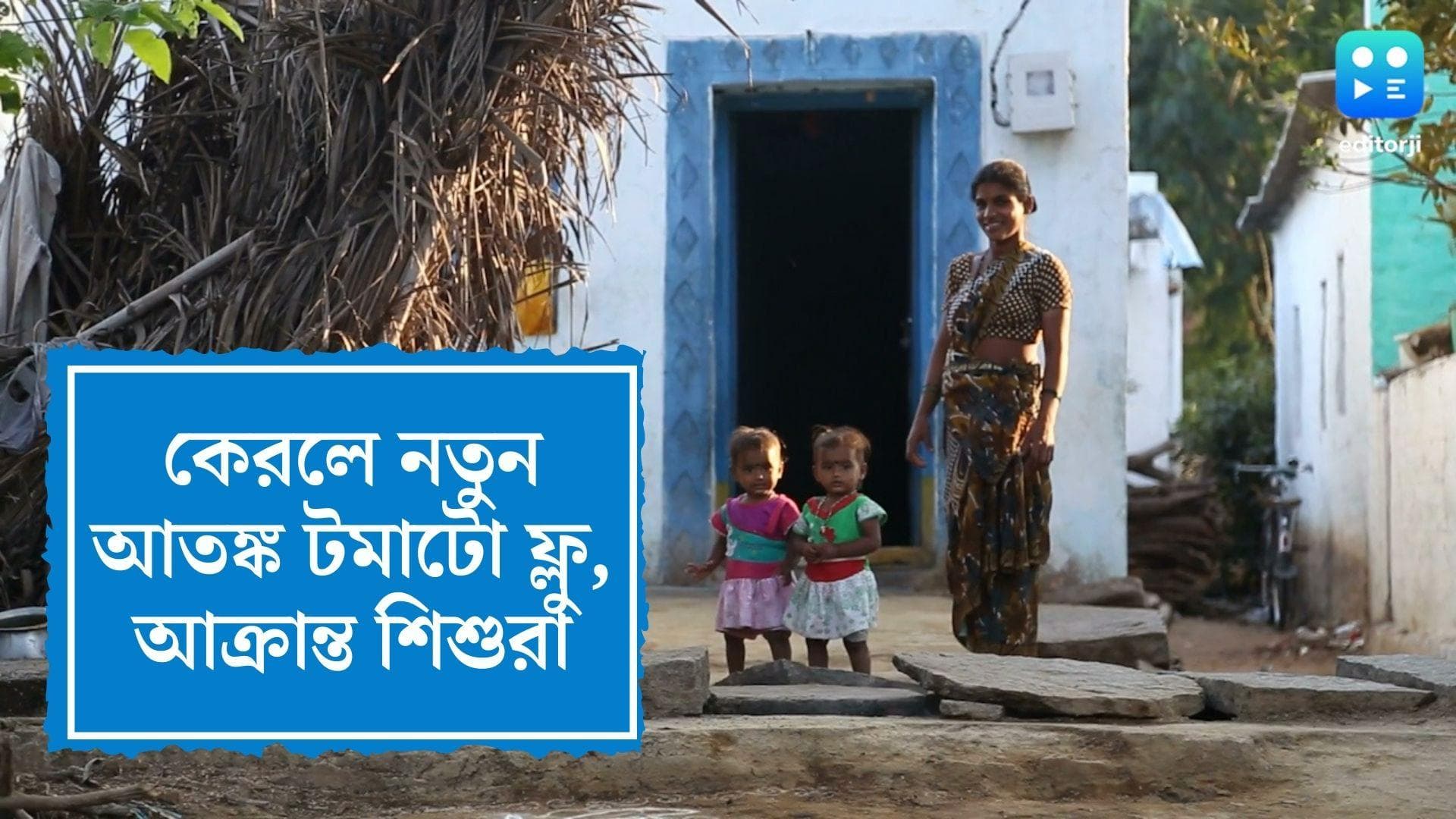 Tomato Flue in Kerala: কেরলে নতুন আতঙ্ক টমাটো ফ্লু, আক্রান্ত ৮০ জন শিশু, জেনে নিন এই রোগের উপসর্গ