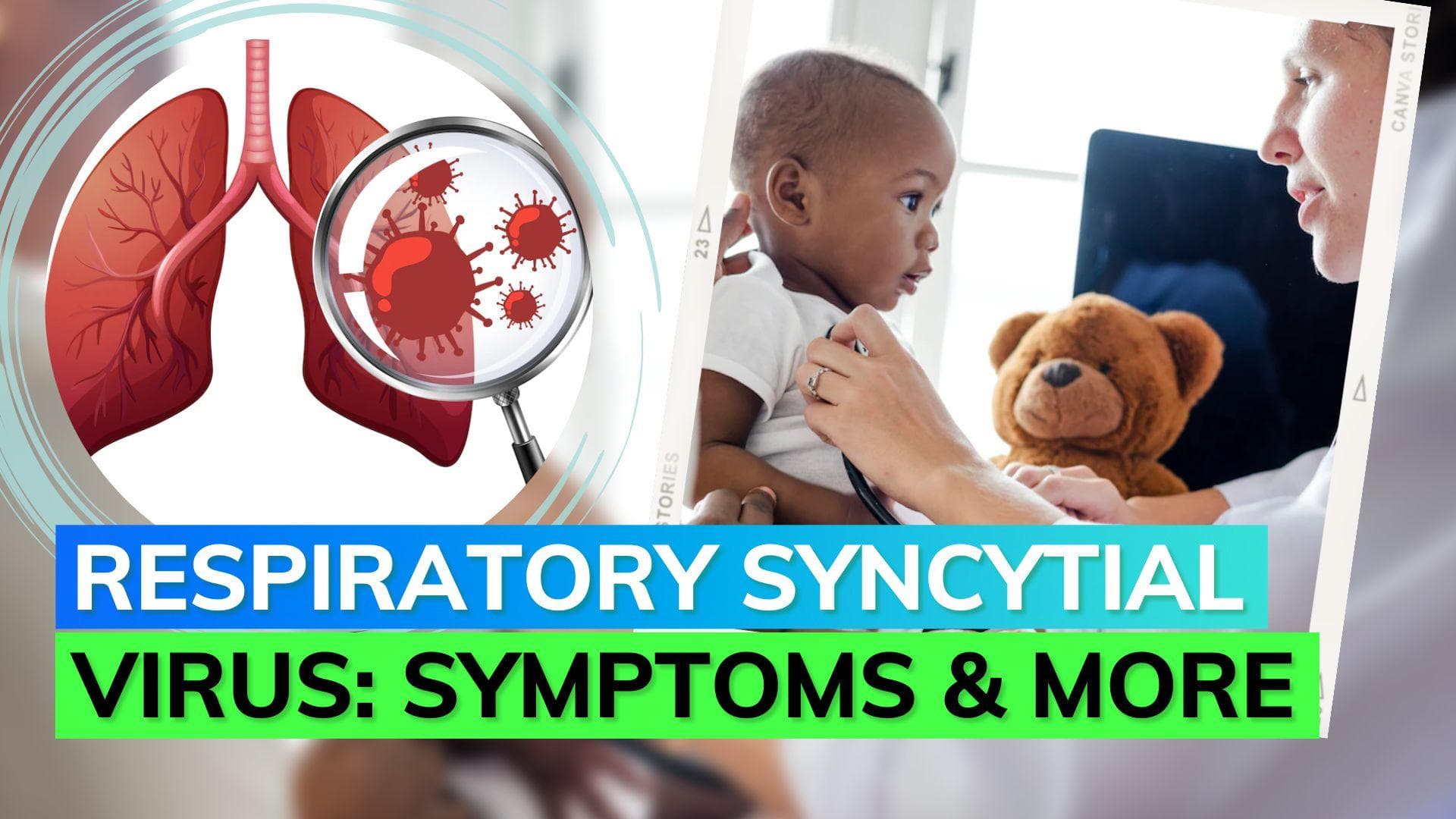 What is RSV? Here's all you need to know about this contagious virus 