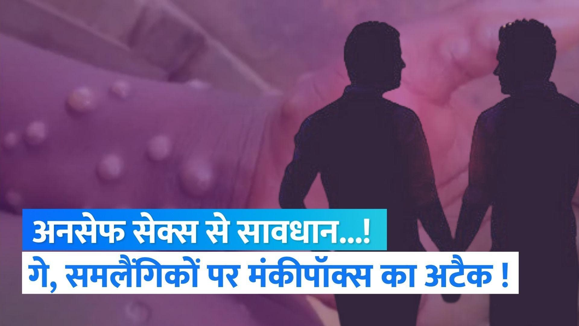 Monkeypox : होमोसेक्स और अनसेफ सेक्स से भी फैल रहा है मंकीपॉक्स ! जानिए क्या है सच्चाई ?