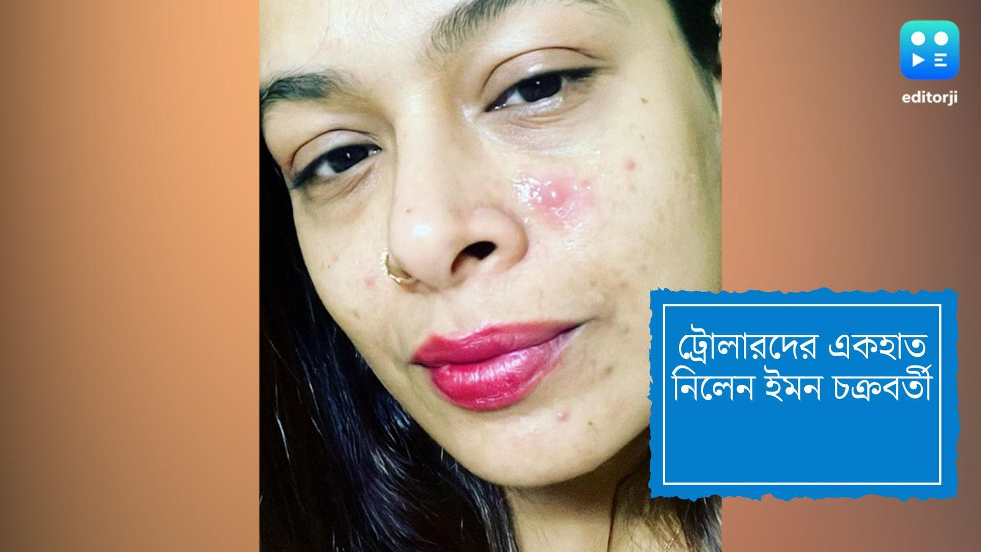 Iman Chakraborty: ব্রণ নিয়েও ট্রোল! জবাব দিলেন সঙ্গীতশিল্পী ইমন চক্রবর্তী