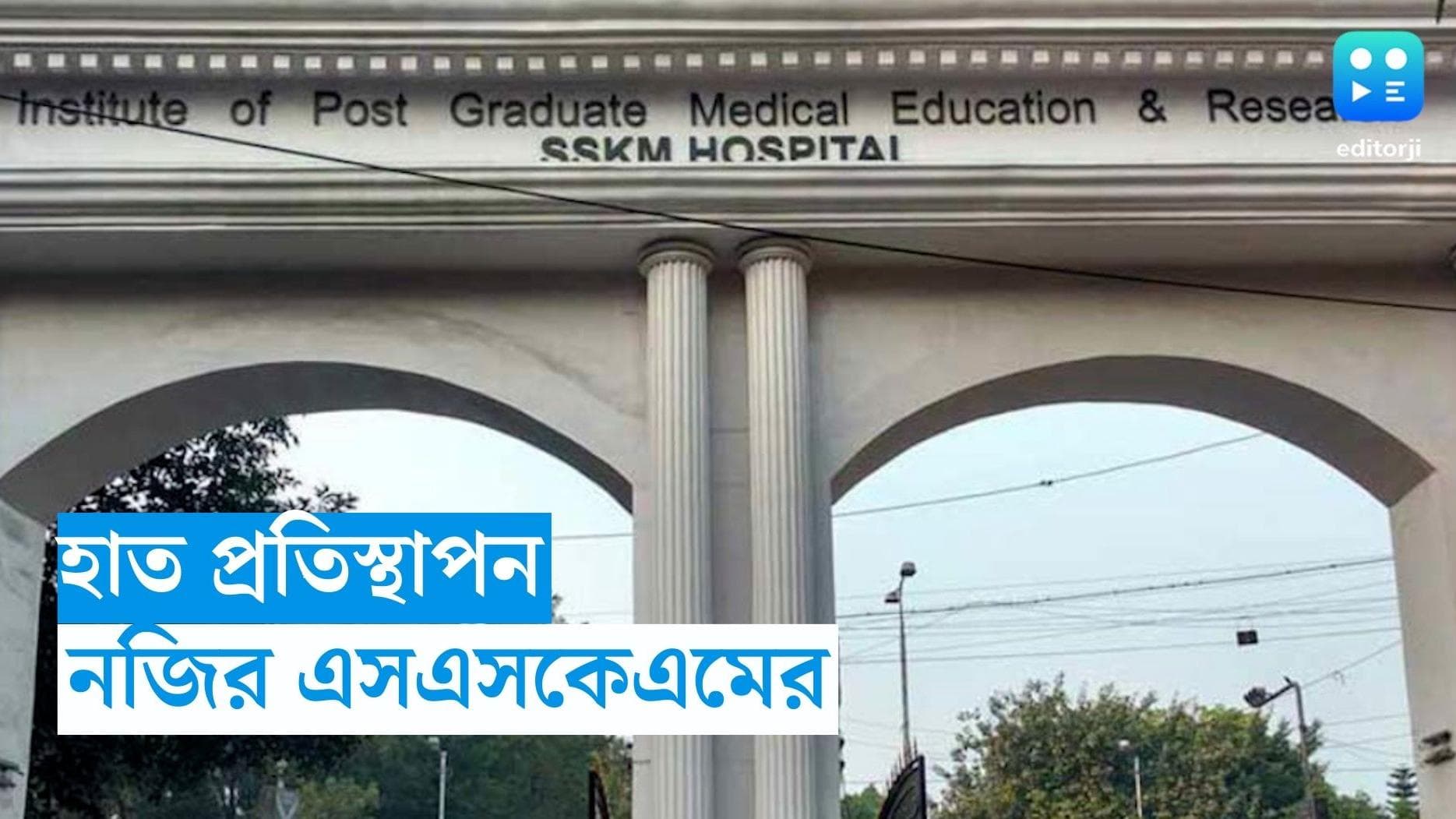 SSKM Hospital News : হাত প্রতিস্থাপনে নজির গড়ল এসএসকেএম, পূর্বাঞ্চলে প্রথম এই অস্ত্রোপচার