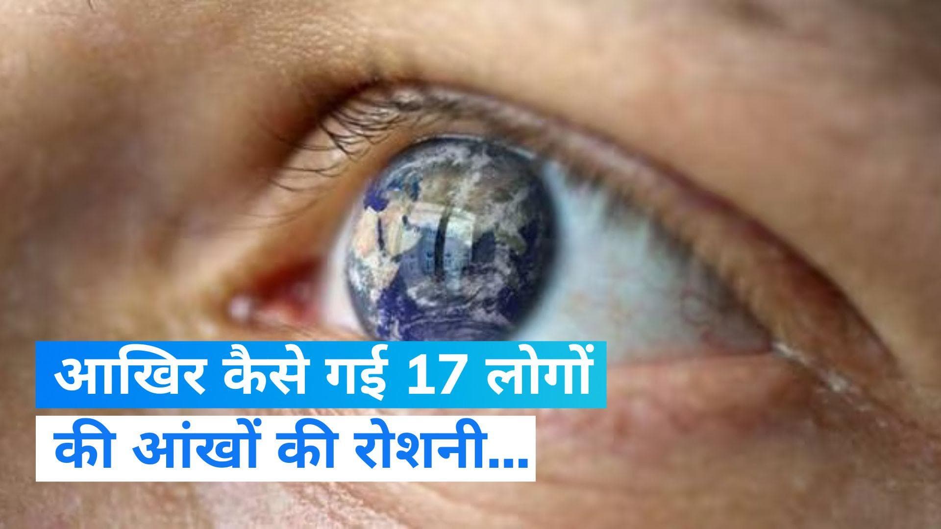 Gujarat: अहमदाबाद में गई 17 लोगों की आंखों की रोशनी, मोतियाबिंद का ऑपरेशन कराने पहुंचे थे मरीज