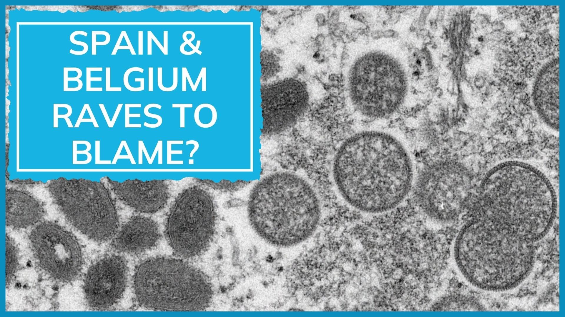 Did Monkeypox spread by sex at 2 raves in Europe? WHO expert answers