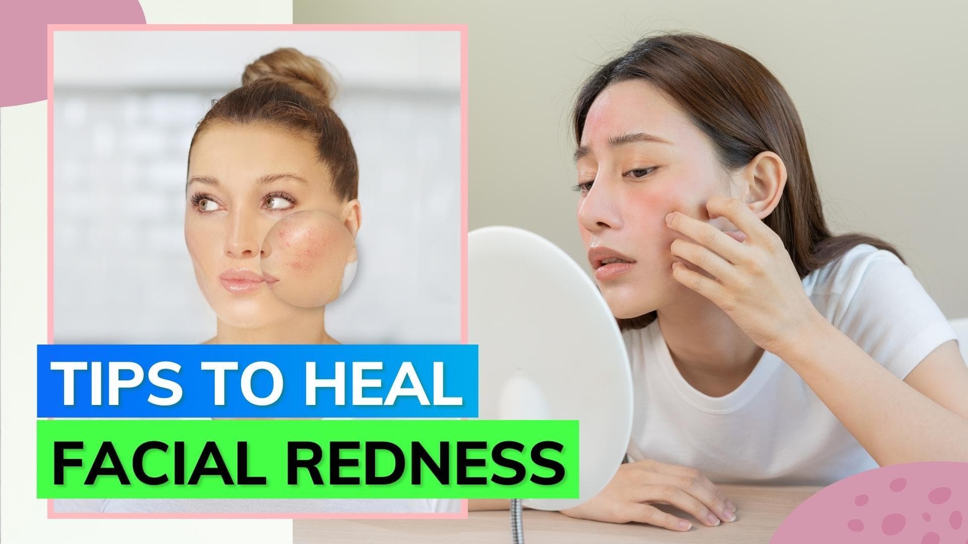 Expert suggests home remedies to prevent facial redness; know how 