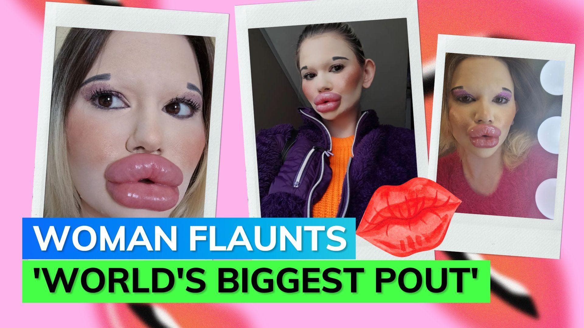 Bulgarian woman shows off world's biggest lips