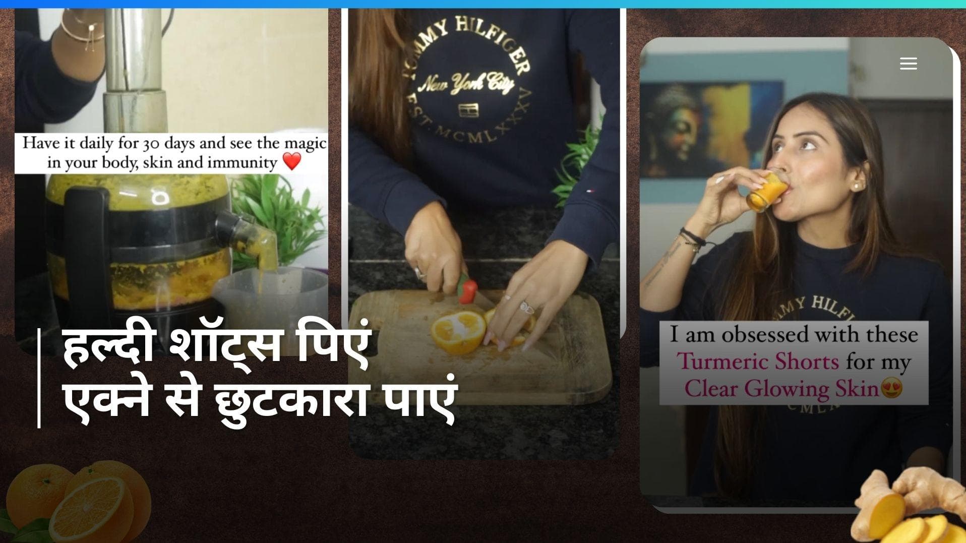 Hormonal Acne: हार्मोनल एक्ने से हैं परेशान? तो अपनी डाइट में शामिल करें हल्दी शॉट्स, जानें रेसिपी 