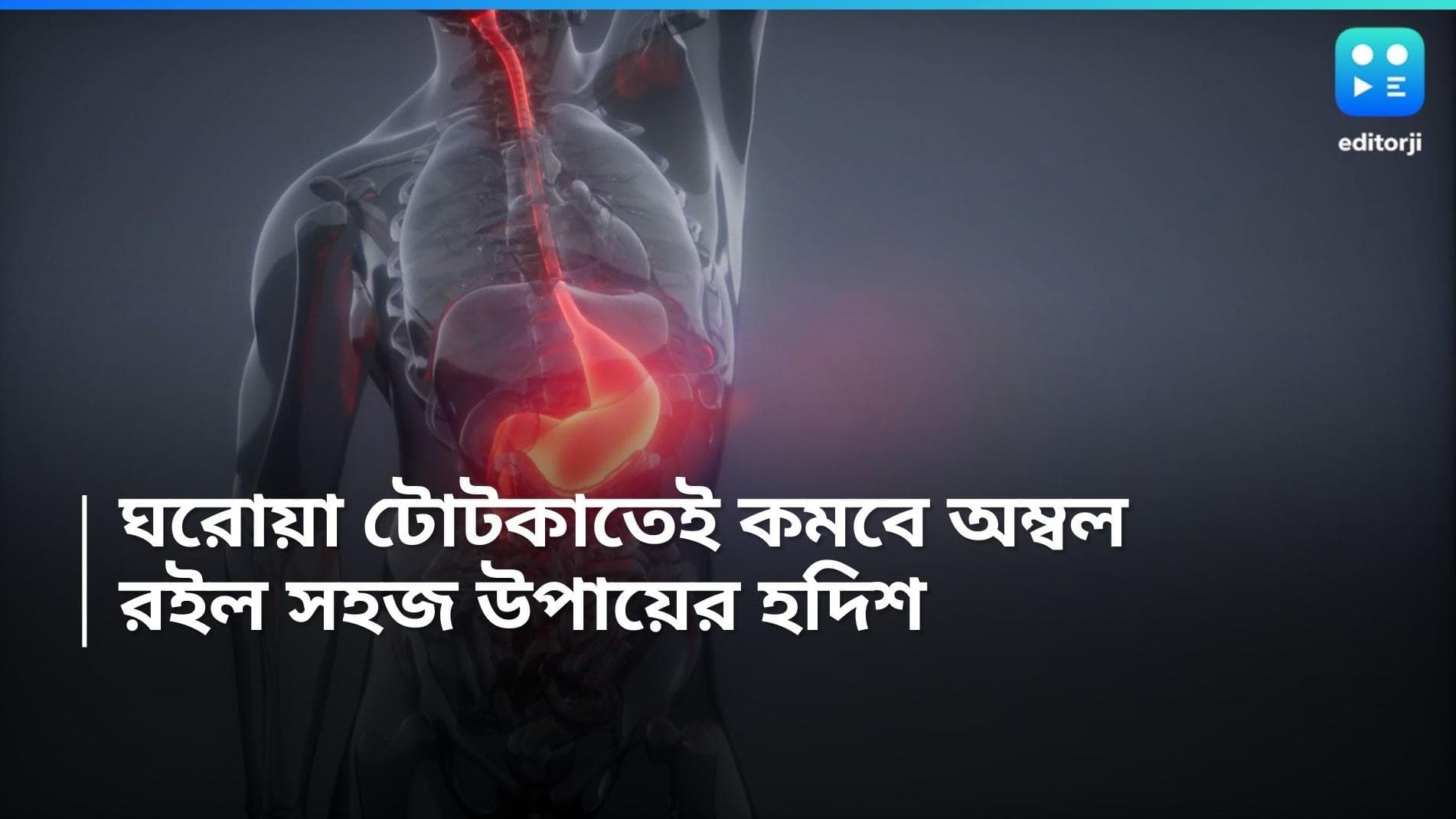 Acidity Relief: কিছু খেলেই গলা জ্বালা, অ্যাসিডিটি থেকে মুক্তির ঘরোয়া টোটকা কী?