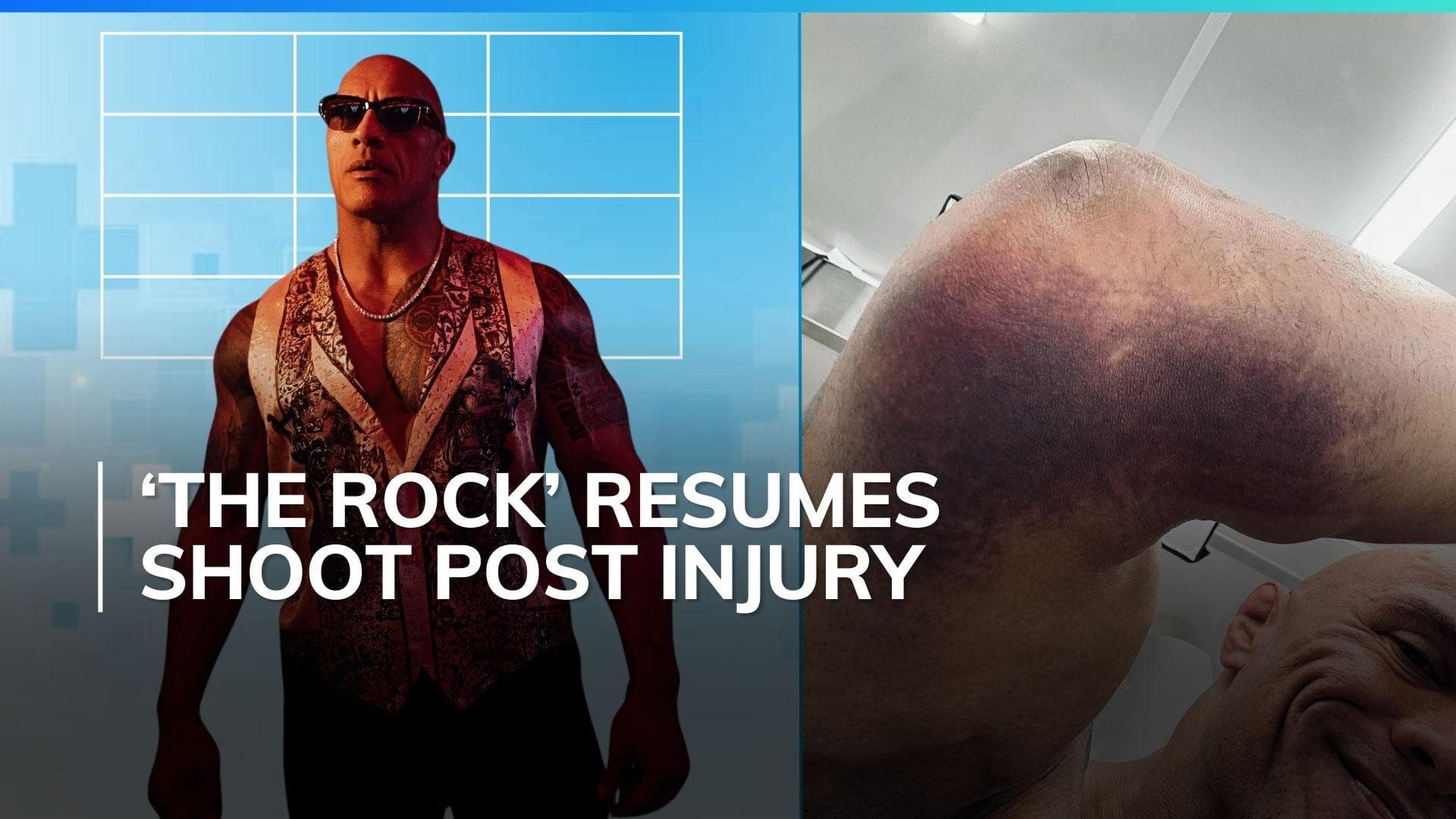 Dwayne Johnson provides health update following elbow injury: 'Elbow got kissed by...'