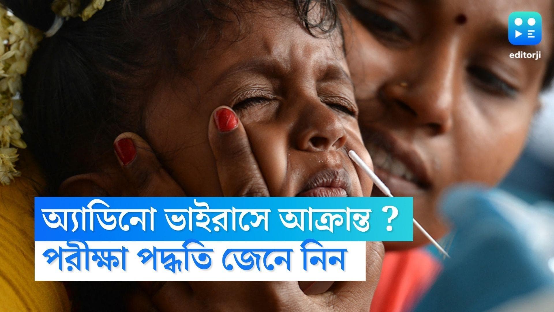 Adeno Virus Symptoms :অ্যাডিনো ভাইরাসে আক্রান্ত ?বুঝবেন কীভাবে ? বিশেষ পরীক্ষা পদ্ধতি সম্পর্কে জেনে নিন