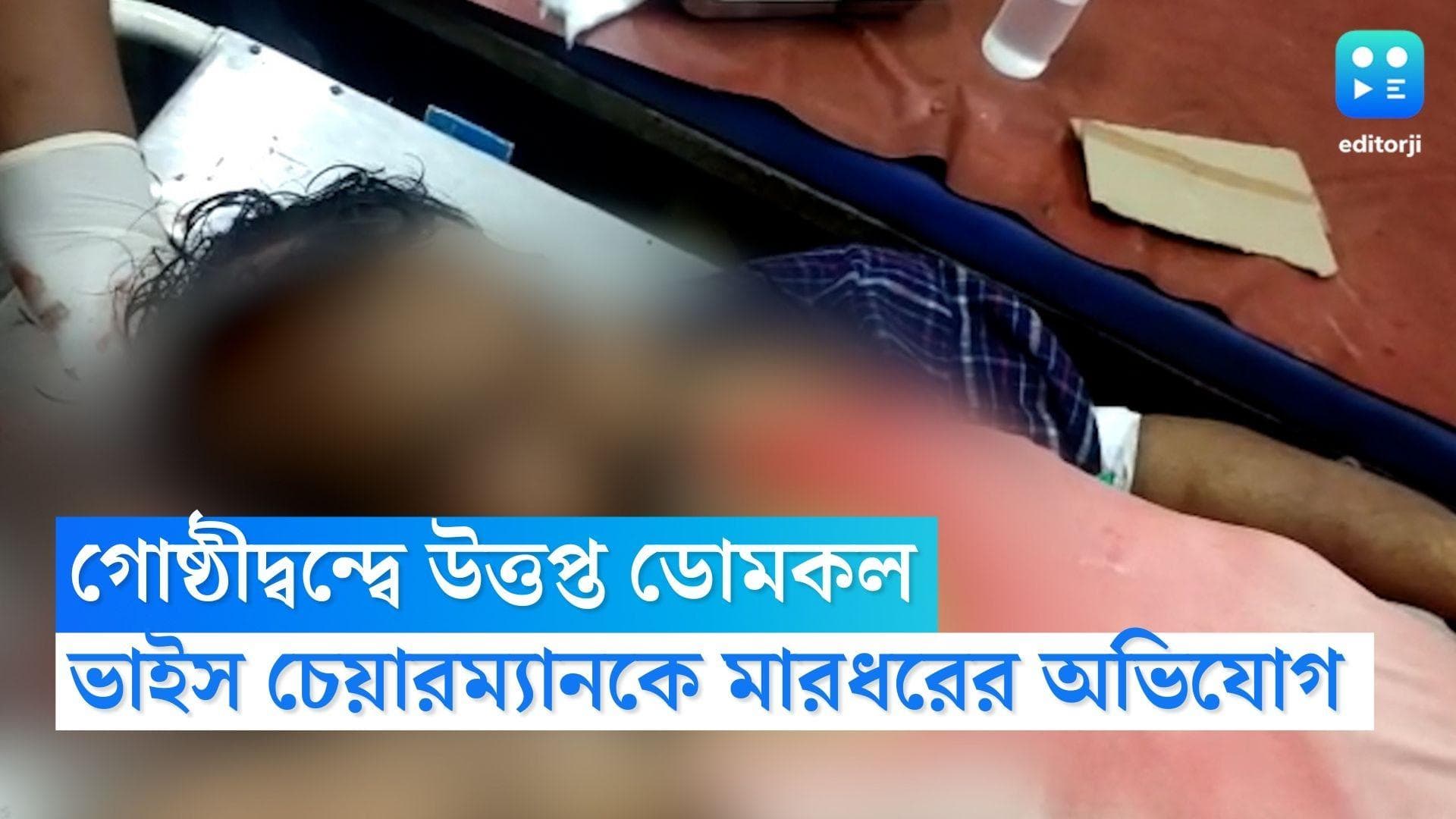 Murshidabad News: আবাস যোজনার টাকা নিয়ে গন্ডগোল, বেধড়ক মারধরের অভিযোগ ডোমকলের ভাইস চেয়ারম্যানকে