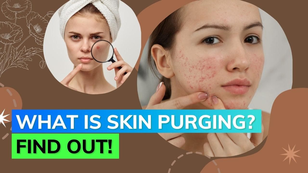 Skin purging: Find out if your new product is helping or hindering