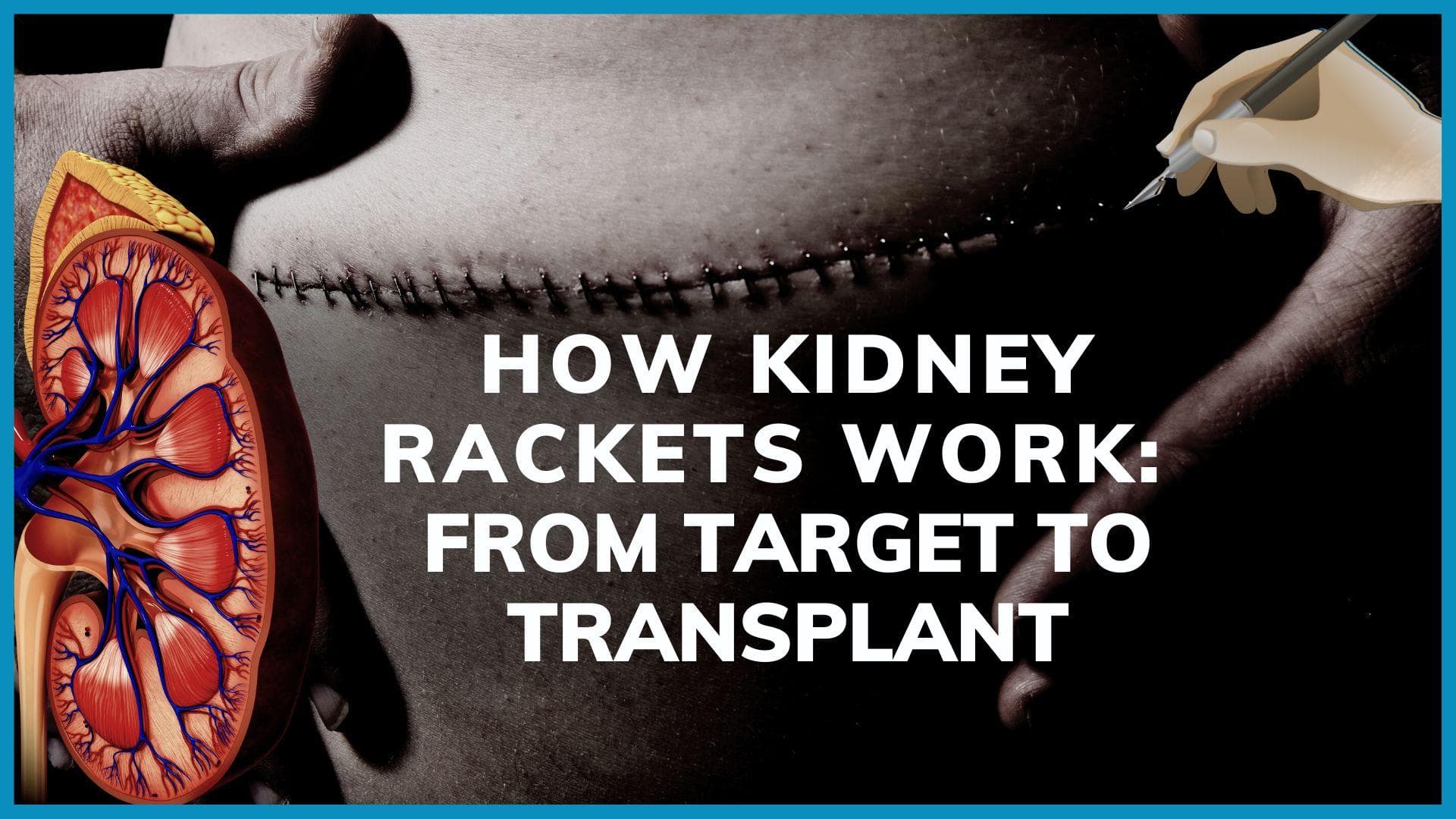 Another kidney racket uncovered: watch how gangs lure victims; why kidney trade is common; what law says