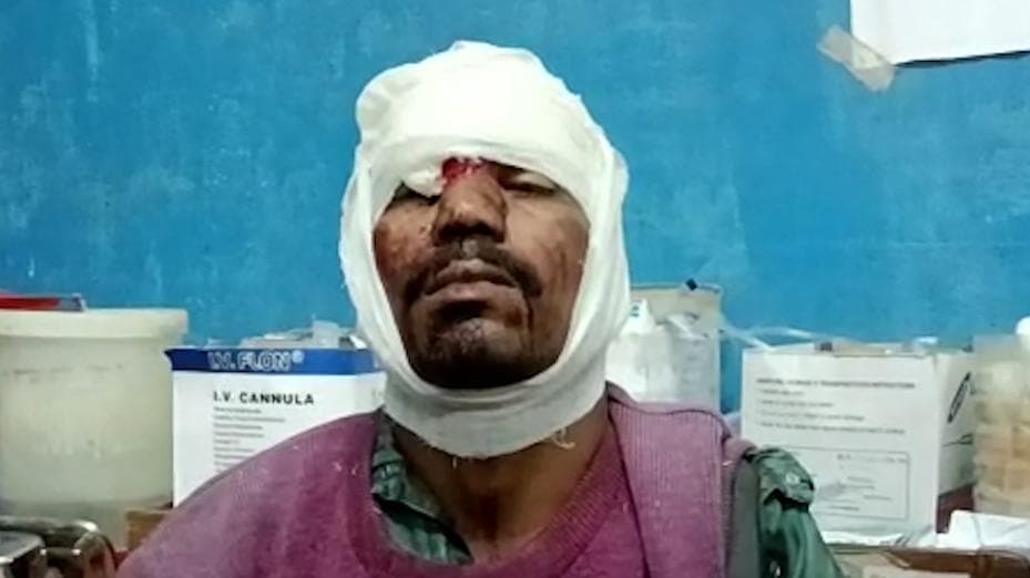 TMC Clash in West Midnapore: কেশপুরে তৃণমূলের গোষ্ঠী সংঘর্ষের অভিযোগ, আহত এক