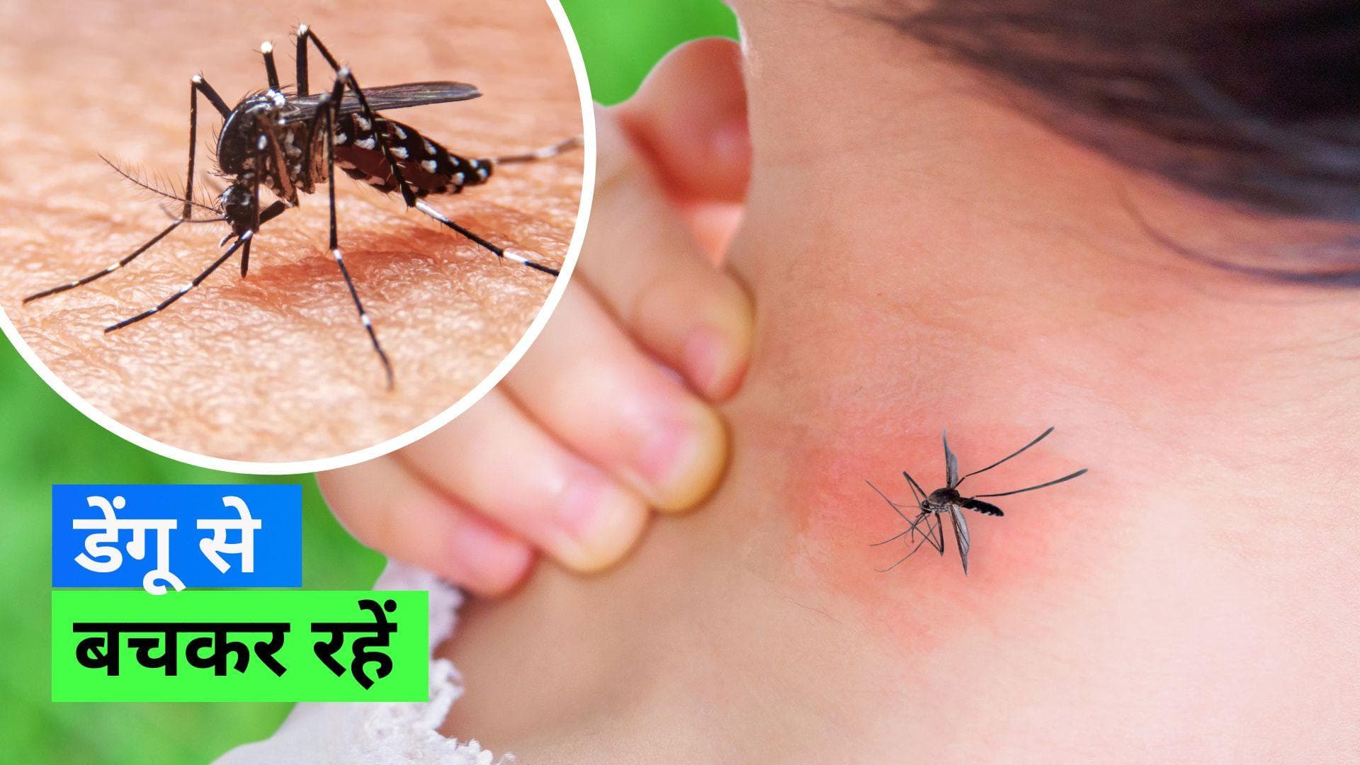 Dengue Fever: बारिश का मौसम आते ही बढ़ा डेंगू का ख़तरा, जान लें इसके लक्ष्ण व बचाव