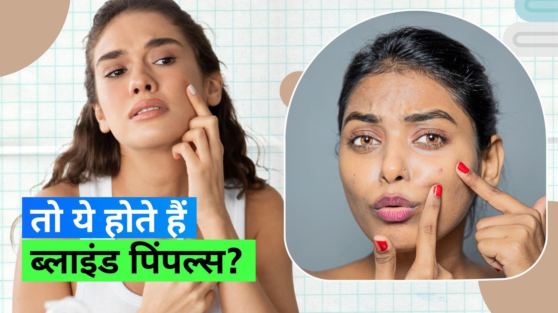 Blind Pimples: क्या होते हैं ब्लाइंड पिंपल्स? जानिए ये होते कैसे हैं और इन्हें ठीक करने का तरीका