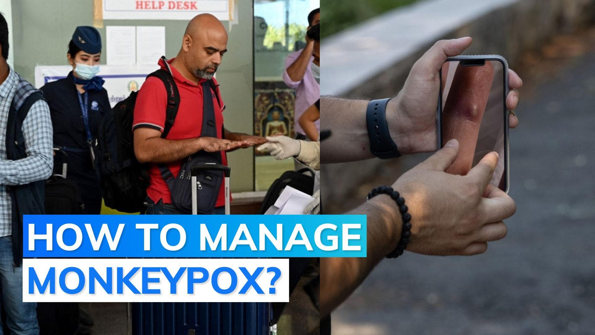 21-day isolation, keeping lesions fully covered: Centre's guidelines for monkeypox patients