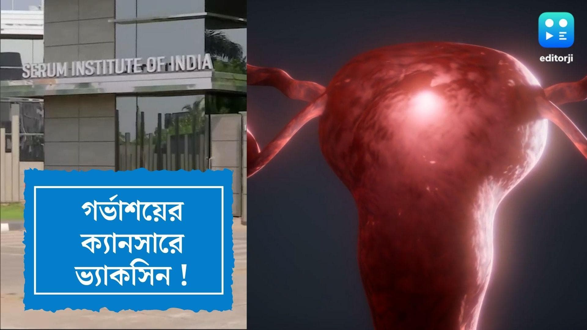 Cancer Vaccine : বছর শেষে ভারতে আসতে পারে ক্যানসারের টিকা, আশায় সেরাম