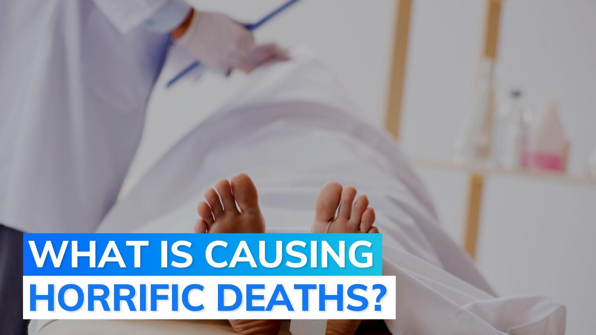 US reports three deaths from rare, flesh-eating bacteria