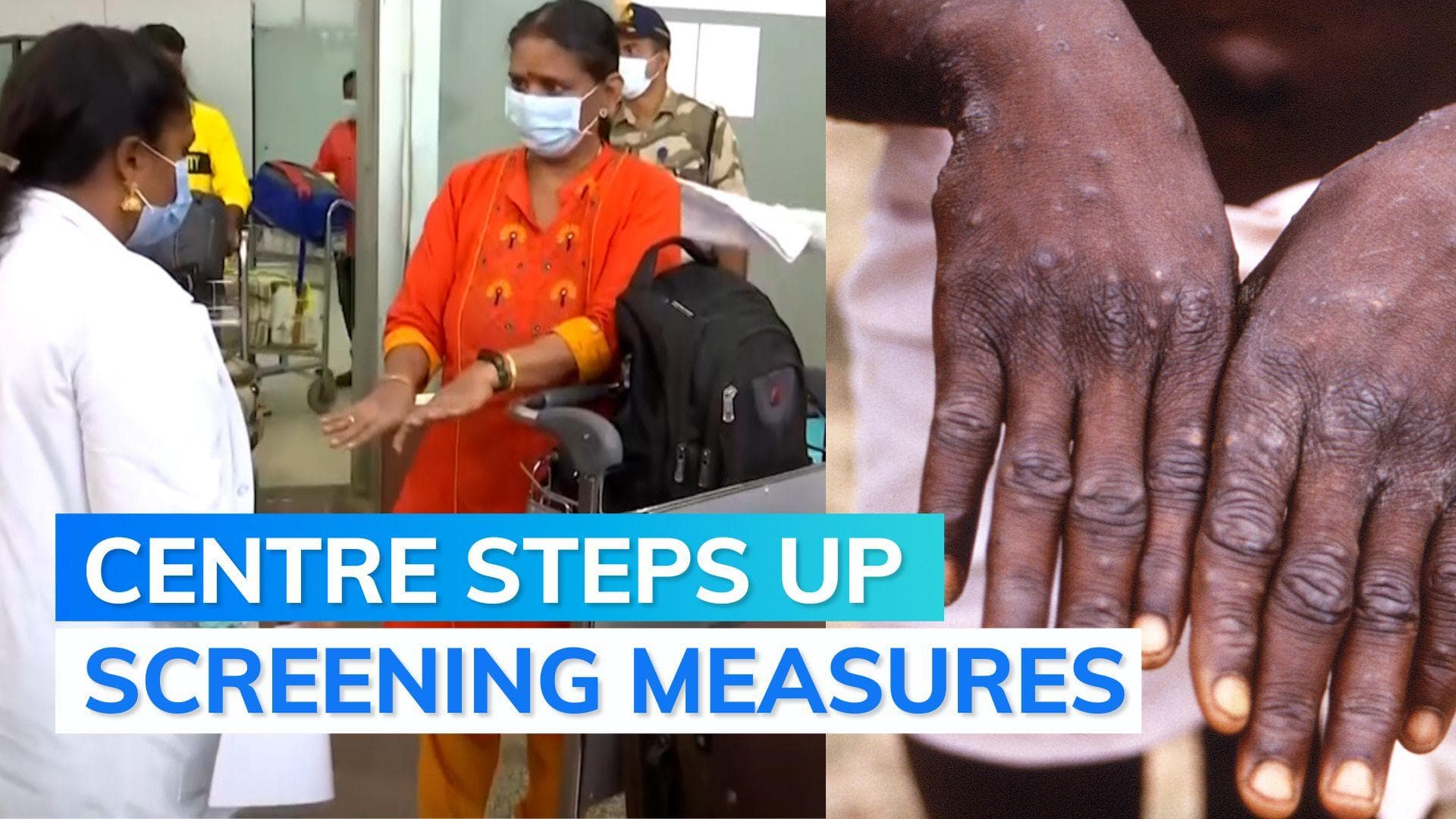Monkeypox: Centre advises strict health screening of all international travellers at entry points