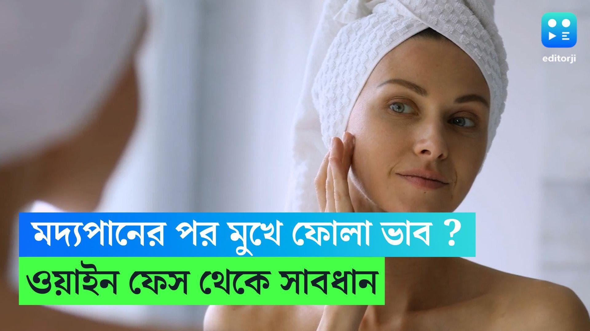 Wine Face: সারারাত মদ্যপানের পর মুখে ফোলা ভাব? পার্টির মরসুমে ওয়াইন ফেস থেকে সাবধান!