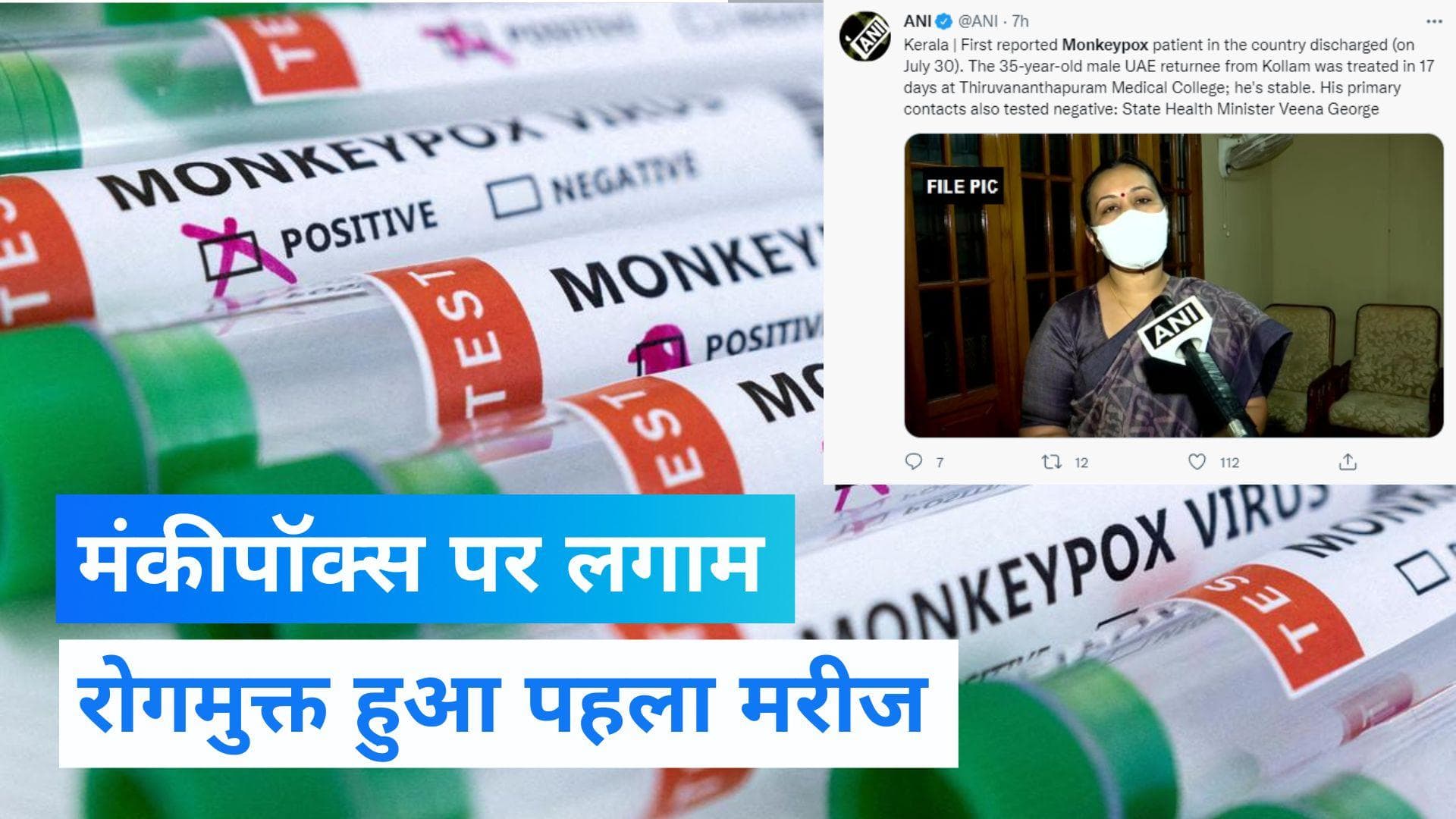 भारत में मंकीपॉक्स से संक्रमित पहला मरीज हुआ ठीक, मरीज को अस्पताल से मिली छुट्टी.