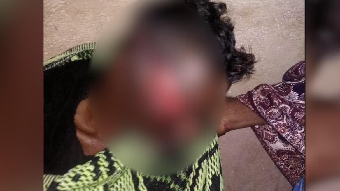 Tiger Attack:  গোসাবা ও কুলতলিতে ২টি বাঘের হানায় জখম মোট ৩ জন