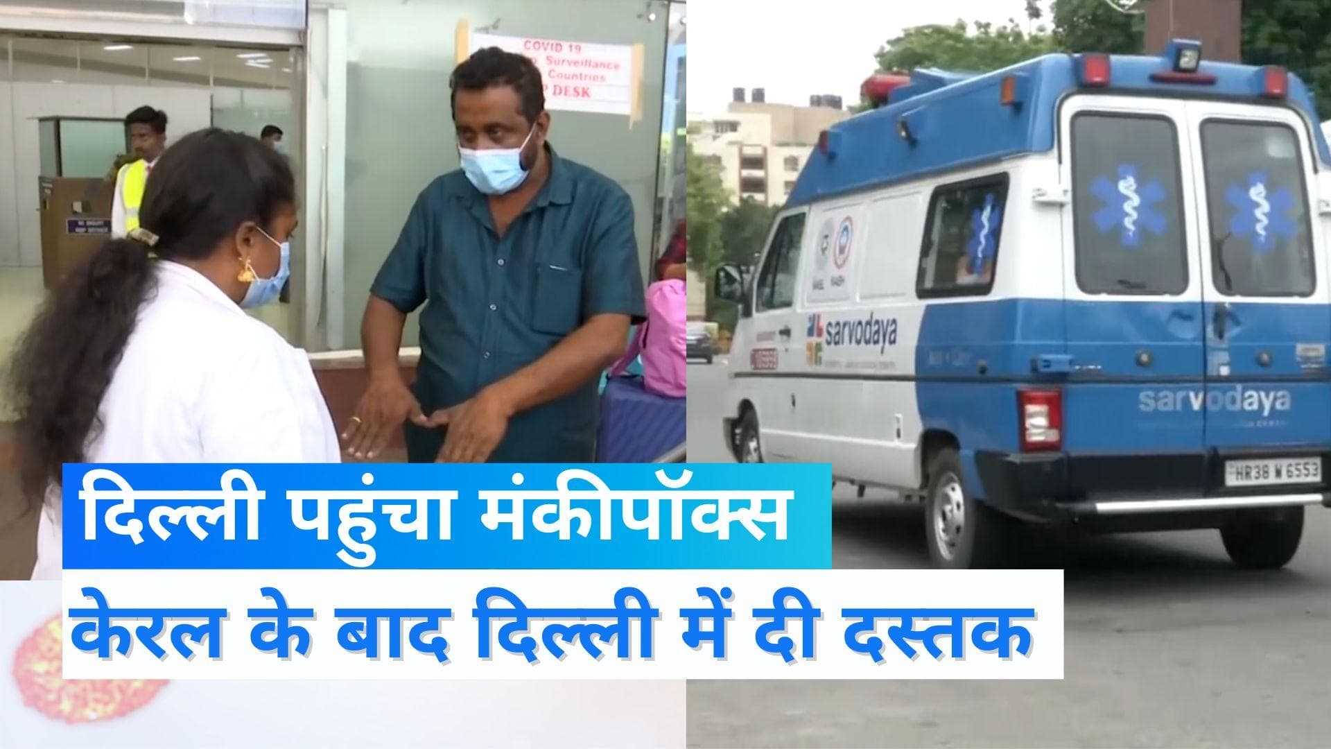 Monkeypox in Delhi: पहला मामला आया सामने, विदेश ट्रेवल हिस्ट्री नहीं होने का दावा