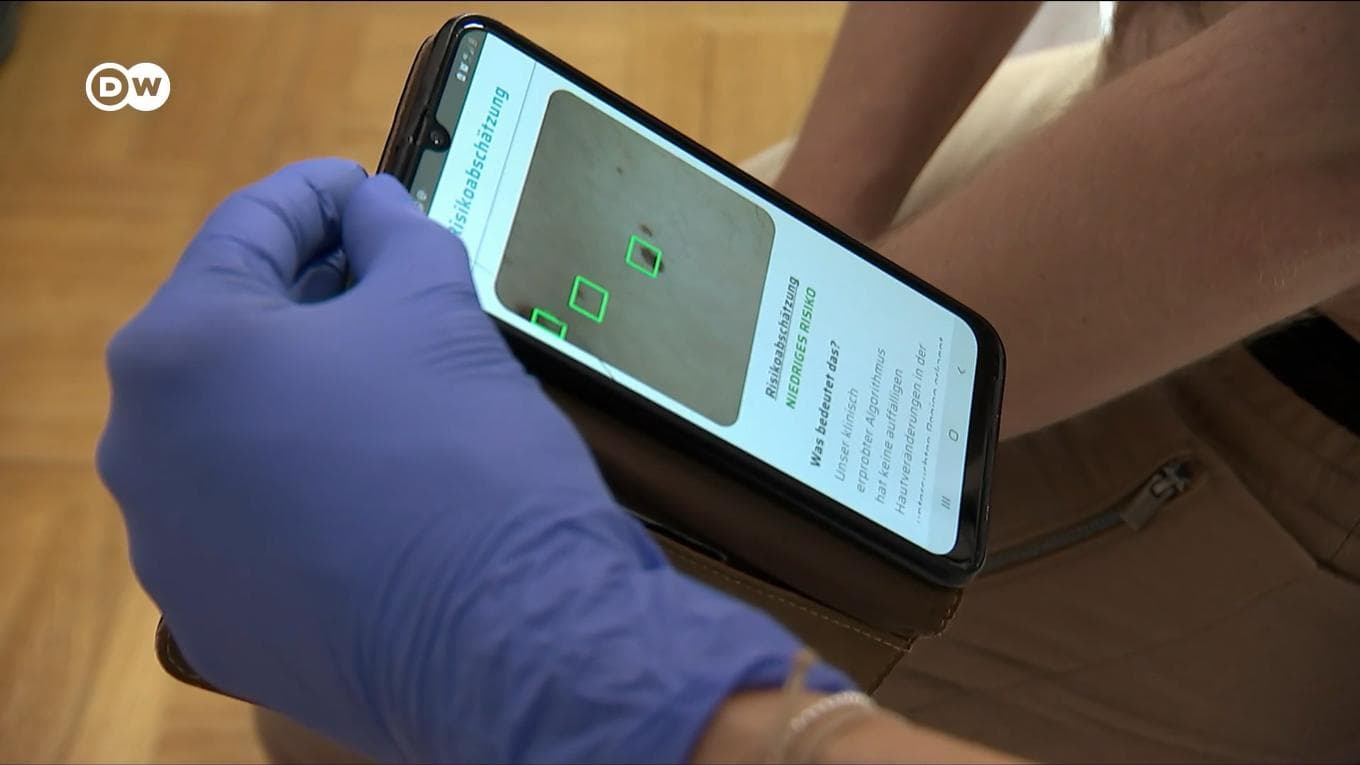 Detecting skin cancer via app