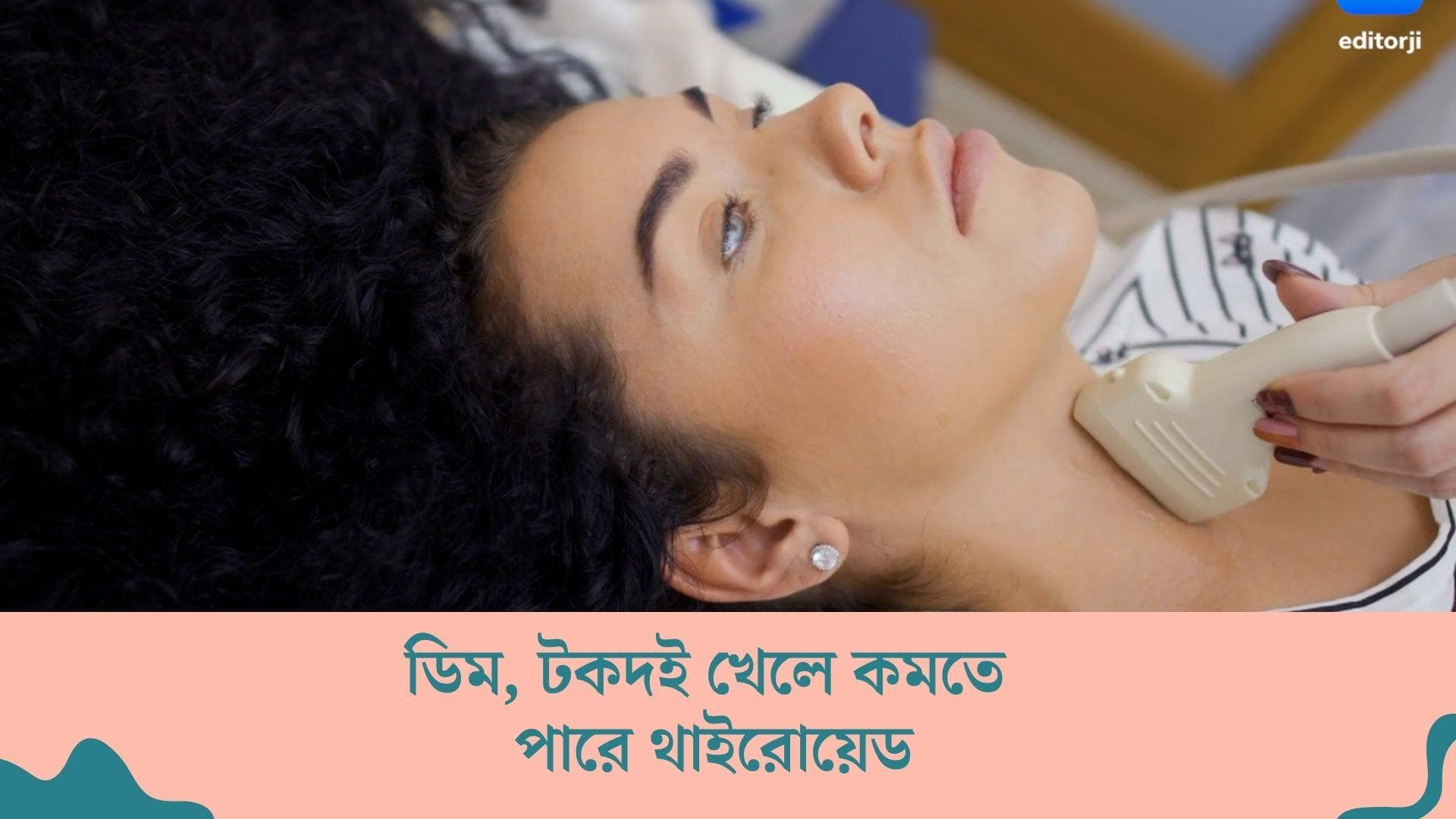 Food for Thyroid Patient :থাইরয়েডের সমস্যায় ভুগছেন ? কোন খাবারগুলি খেলে নিয়ন্ত্রণে থাকবে এই রোগ, দেখে নিন