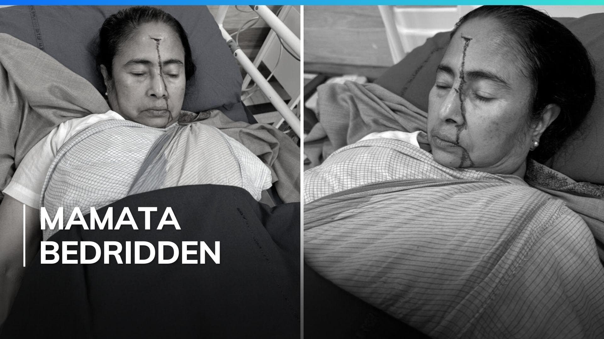 West Bengal CM Mamata Banerjee suffers 'major injury'